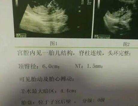 深圳做代孕去哪家医院好 在深圳做三代试管婴儿大概要多少钱。 ‘怀女儿的孕