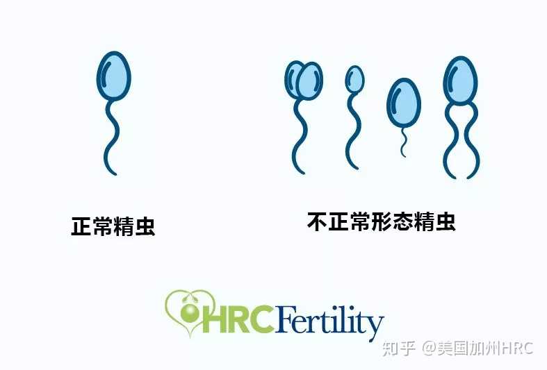 广州试管婴儿技术,广州有哪些知名的三代试管私立机构？?